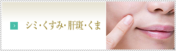 シミ・くすみ・肝斑・くま