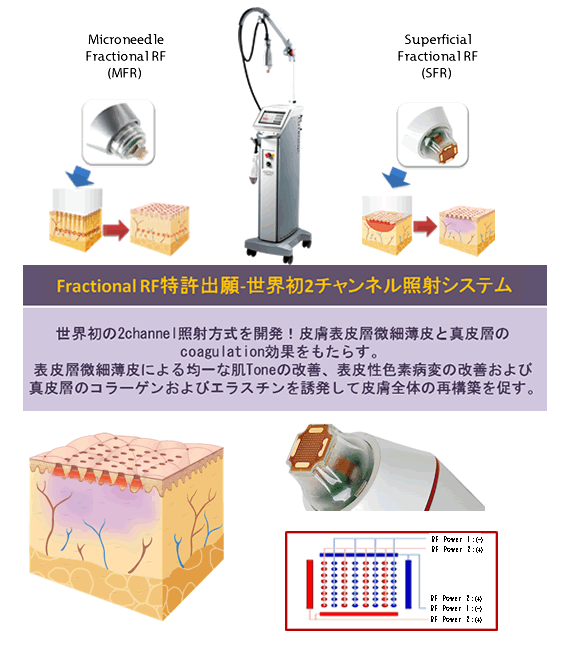 インフィニハイブリッド概要