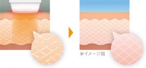 ファームアップ