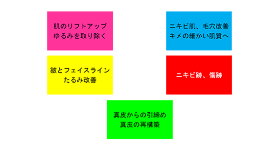 インフィニハイブリッド効果