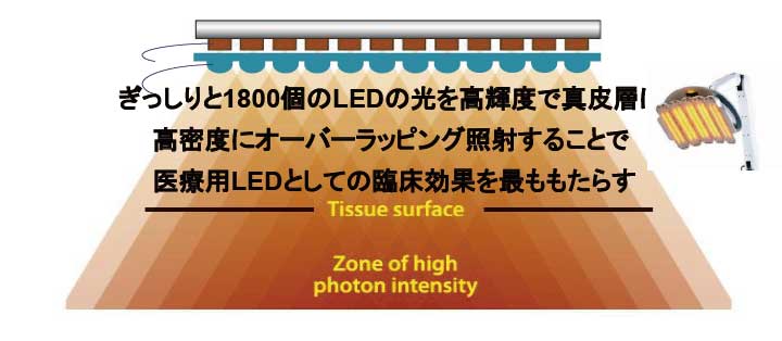 医療用ＬＥＤヒーライトⅡ