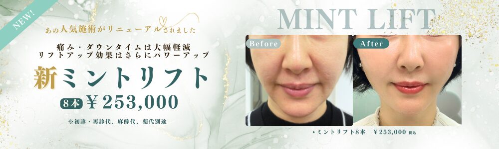 ミントリフト